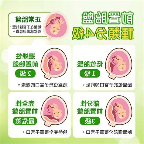 前置胎盤 症狀